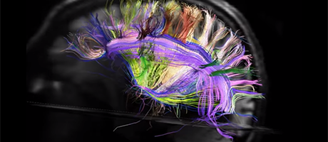 Brain’s Wiring Revealed in HD - cover image