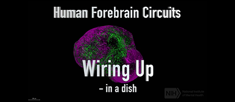 screenshot from video titled Human Forebrain Circuits Wiring