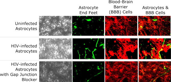Enlarged microscope images of uninfected astrocytes, HIV-infected astrocytes, and HIV-infected astrocytes grown with gap junction blockers. Special staining techniques show how HIV infection results in irregular development of astrocyte end feet, disrupted growth of cells associated with the blood-brain barrier, and abnormal connections between the two. Gap junction blockers help to reduce these effects.