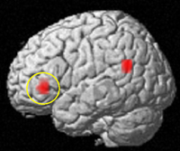 Opposite frontal activity in response to midbrain dopamine