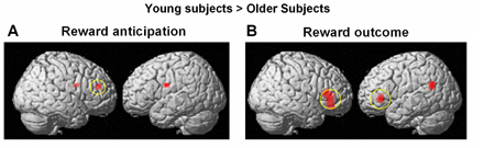 Opposite frontal activity in response to midbrain dopamine