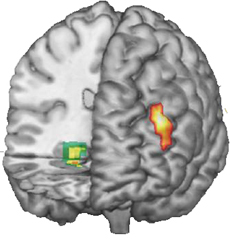 Brain areas where activity differed