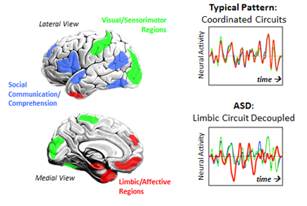 brain images and graphs showing lost connectivity