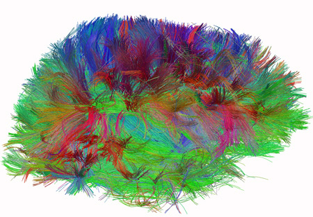 diffusion spectrum imaging of human brain
