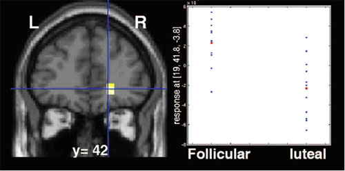 fMRI scan data showing orbitofrontal cortex and chart showing different levels of reward circuit activity, depending on menstrual cycle phase