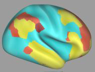 Smarts, life satisfaction, income and education levels – and other measures of success – were correlated with increased connectivity between certain areas of the brain while at rest.  These parts of the brain (yellow, red, brown) talked with each other more while higher-scoring participants weren’t doing anything in particular. Picture shows composite data from functional magnetic resonance imaging scans.