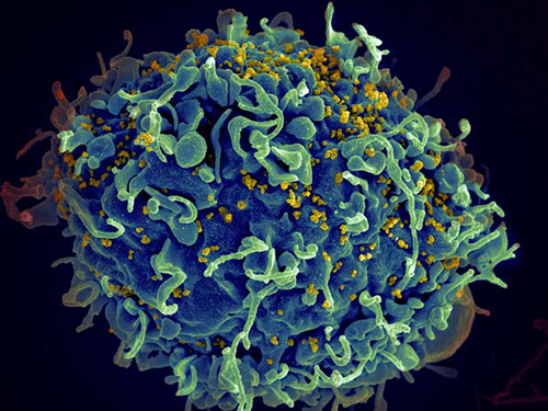HIV infecting human immune cell