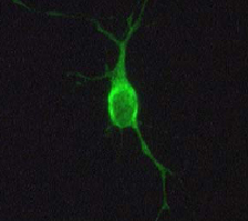 Rat neuron expressing Isoform 3.1