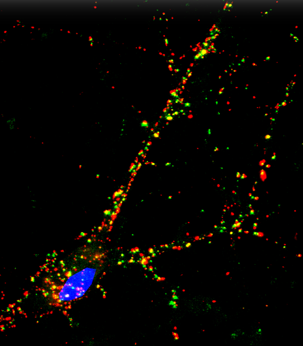 Synapses in mature iPSC cortex neuron Hongjun Song iPSC
