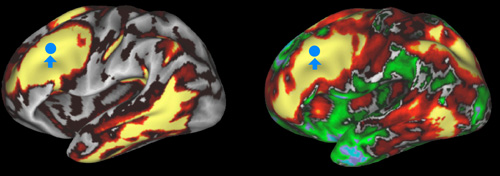 structural and functional connectivity in human brain