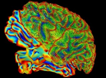 A multi-color rendering of whole brain based on functional magnetic resonance imaging scan.