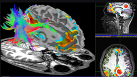 Colored, cross-sections of brain from functional magnetic resonance imaging data.