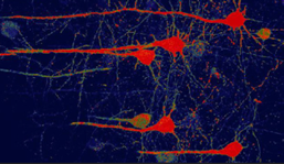 A scan of neurons (colored red) converted from glial cells using a new NeuroD1-based gene therapy in mice.