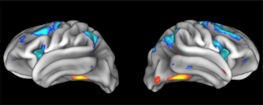 A colored MRI scan of two adolescent brains activated during a memory task.
