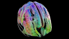 A multicolored model that shows several portions of the brain’s white matter—bundles of fiber that carry nerve signals between the brain and the body, as well as within the brain itself. 