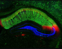 Multicolored, distinct neural connections in a cross section of a mouse’s hippocampus, a region of the brain involved in the memory of facts and events.