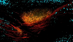 A zoomed, colored view of many neural cell bodies and their arm-like extensions from a part of a mouse brain that’s known for its role in controlling voluntary movement.
