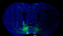 Researchers mapped new connections in the extended amygdala related to reward-seeking and aversion. Here neurons in that pathway appear as fluorescent green in a cross-section of a mouse brain.