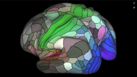 A colored functional MRI image showing areas connected to the three main senses – hearing, touch, and sight.