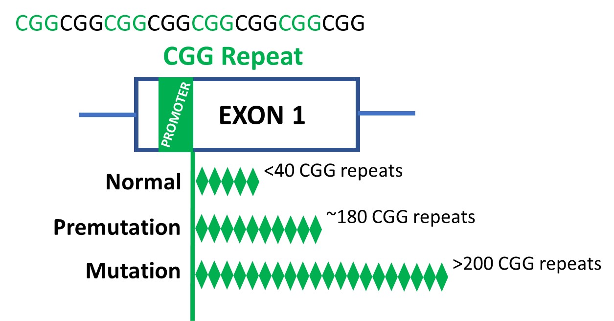 Schematic of CGG repeat showing the three lengths in Exon 1: normal (less than 40 CGG repeats, premutation (about 180 CGG repeats), mutation (over 200 CGG repeats).