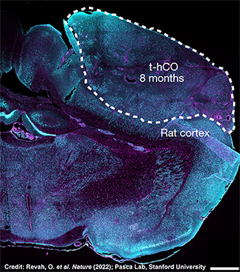 Example of a transplanted human cortical organoid (t-hCO) in the rat cortex.