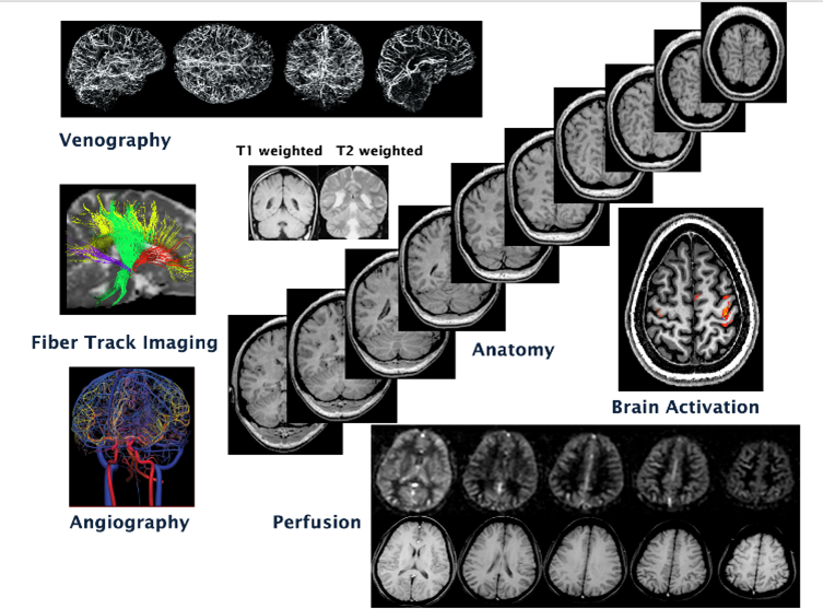 Examples of the many types of structural, physiological, and functional contrast available from MRI. Courtesy of NIMH.