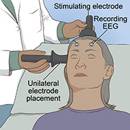 Treat life ECT Digital Electro Convulsive Therapy Unit Threatening ECT  Machine D