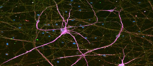 Pink neurons with blue nucleus