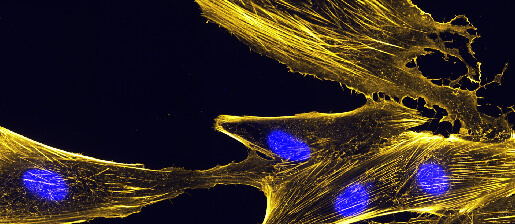 Yellow neurons with blue nucleus