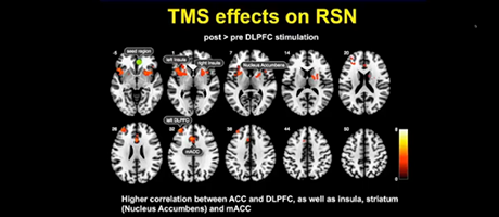 NIH Multimodal Brain Stimulation Speaker Series – Christian Windischberger and Faranak Farzan