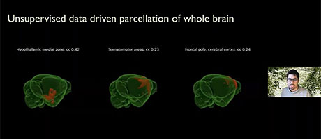 2022 High Throughput Imaging Characterization of Brain Cell Types & Connectivity-Day 2, Part 5 video thumbnail