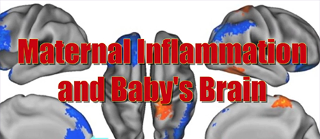 screenshot from Maternal Inflammation and Baby's Brain - Claudia Buss, Ph.D
