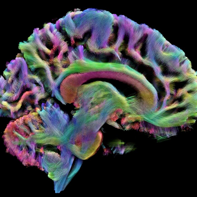 Multi-colored brain generated by diffusion magnetic resonance imaging (MRI).  Courtesy of James Stanis and Arthur W. Toga, USC Laboratory of Neuro Imaging at the USC Mark and Mary Stevens Neuroimaging and Informatics Institute.