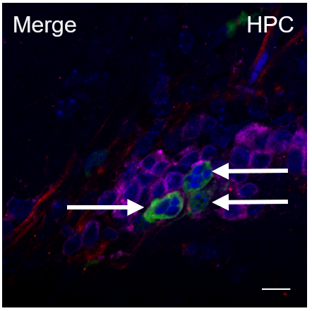 Image showing HIV infection of CD4+ T cells in the mouse brain. Human T cells (magenta), human astrocytes (red), HIV (green), nuclei (Blue). Arrows identify uptake of HIV from astrocytes into T cells. Credit: Al-Harthi et al. (2020)