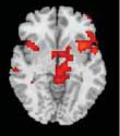 hubs of salience network