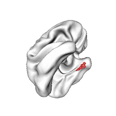 Left Entorhinal Cortex