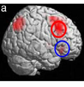 Areas of activation