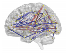 Brain scan showing connectivity related to repetitive behaviors