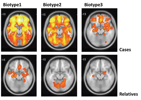 Biotypes MRI