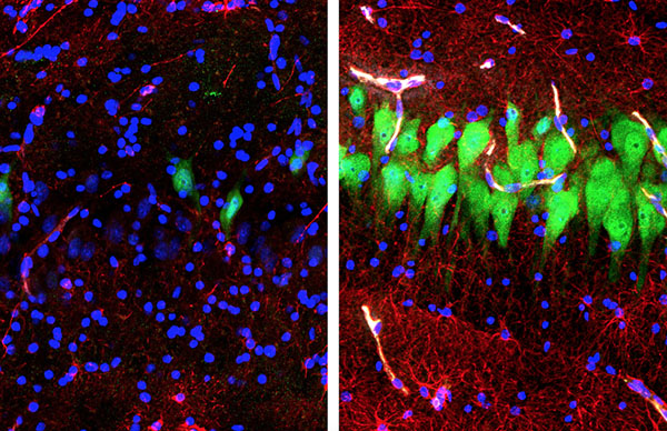 Immunofluorescent stained neurons, astrocytes, and cell nuclei in hippocampal CA3 region of brain