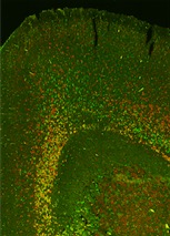 Epigenomic signatures of neuron subtypes 