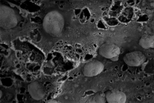 A high-powered black and white microscope image showing exosomes, nanosized parts of cells. (Credit: Surya Shrivastava / City of Hope