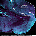 Example of a transplanted human cortical organoid (t-hCO) in the rat cortex. Credit: Revah, O. et al. Nature (2022); Pasca Lab, Stanford