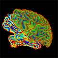 multicolored brain scan image