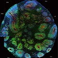 brain scan showing molecular structure