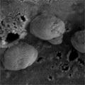  A high-powered black and white microscope image showing exosomes, nanosized parts of cells. (Credit: Surya Shrivastava / City of Hope