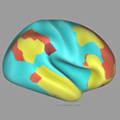 Smarts, life satisfaction, income and education levels – and other measures of success – were correlated with increased connectivity between certain areas of the brain while at rest.  These parts of the brain (yellow, red, brown) talked with each other more while higher-scoring participants weren’t doing anything in particular. Picture shows composite data from functional magnetic resonance imaging scans.
