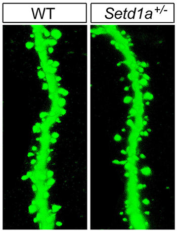 Neuronal spines