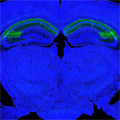 highlighted CA2 region of hippocampus in mouse brain