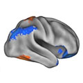 MRI scan of infant's brain